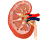 kidney3.gif